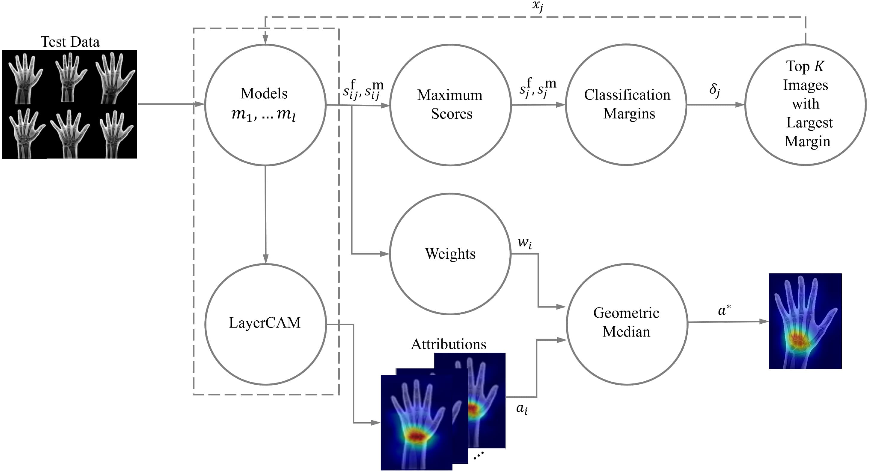 Hand X-ray segmentation pipeline using SAM